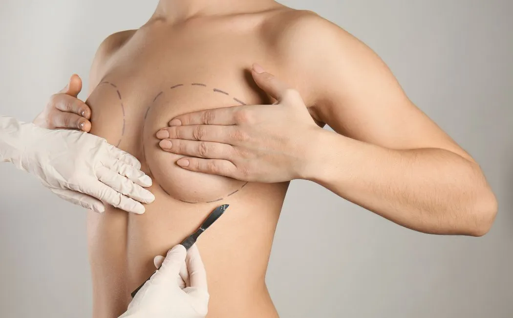 Kosmetyczna augmentacja piersi - co musisz wiedzieć przed zabiegiem