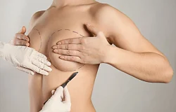 Kosmetyczna augmentacja piersi - co musisz wiedzieć przed zabiegiem